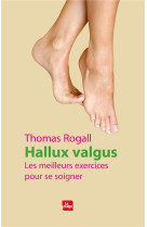 Hallux valgus