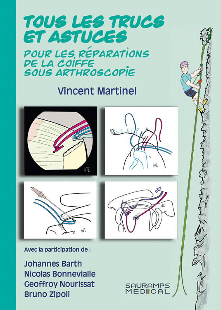 TOUS LES TRUCS ET ASTUCES POUR LES REPARATIONS DE LA COIFFE SOUS ARTHROSCOPIE - Vincent MARTINEL - SAURAMPS MEDICA